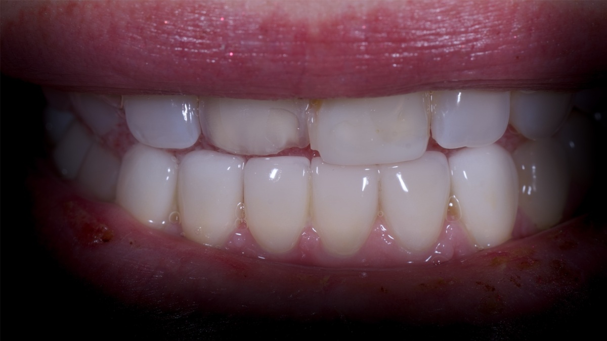 Исходная клиническая ситуация