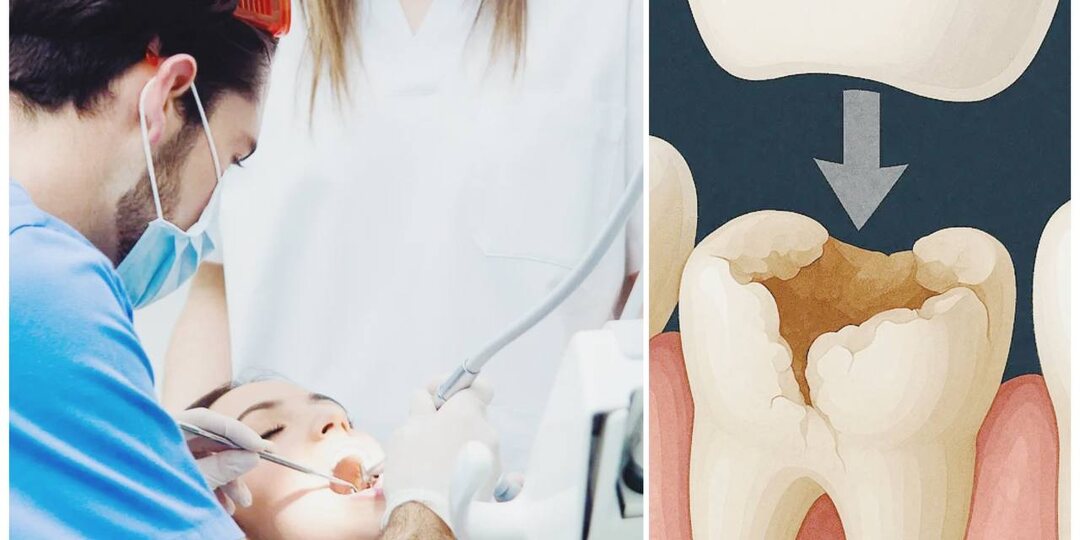 От зуба остался только корень - трогать или оставить?