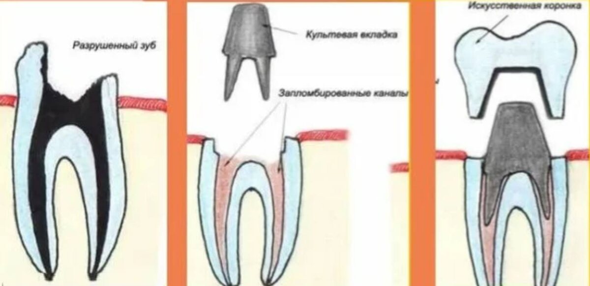 Один из вариантов решения проблемы