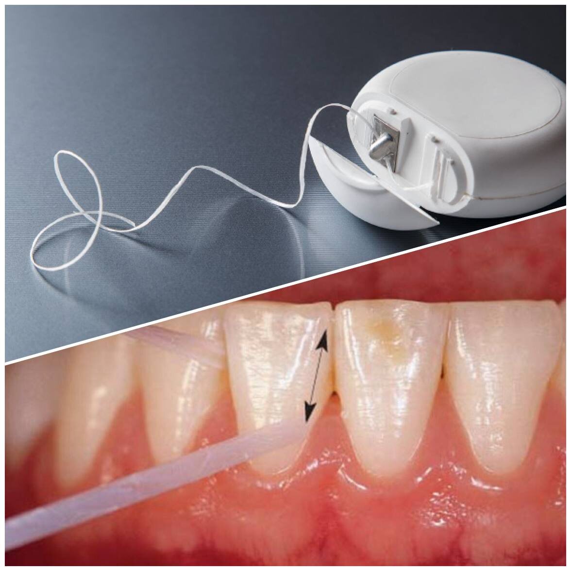 Иногда зубная нить не лучшее решение