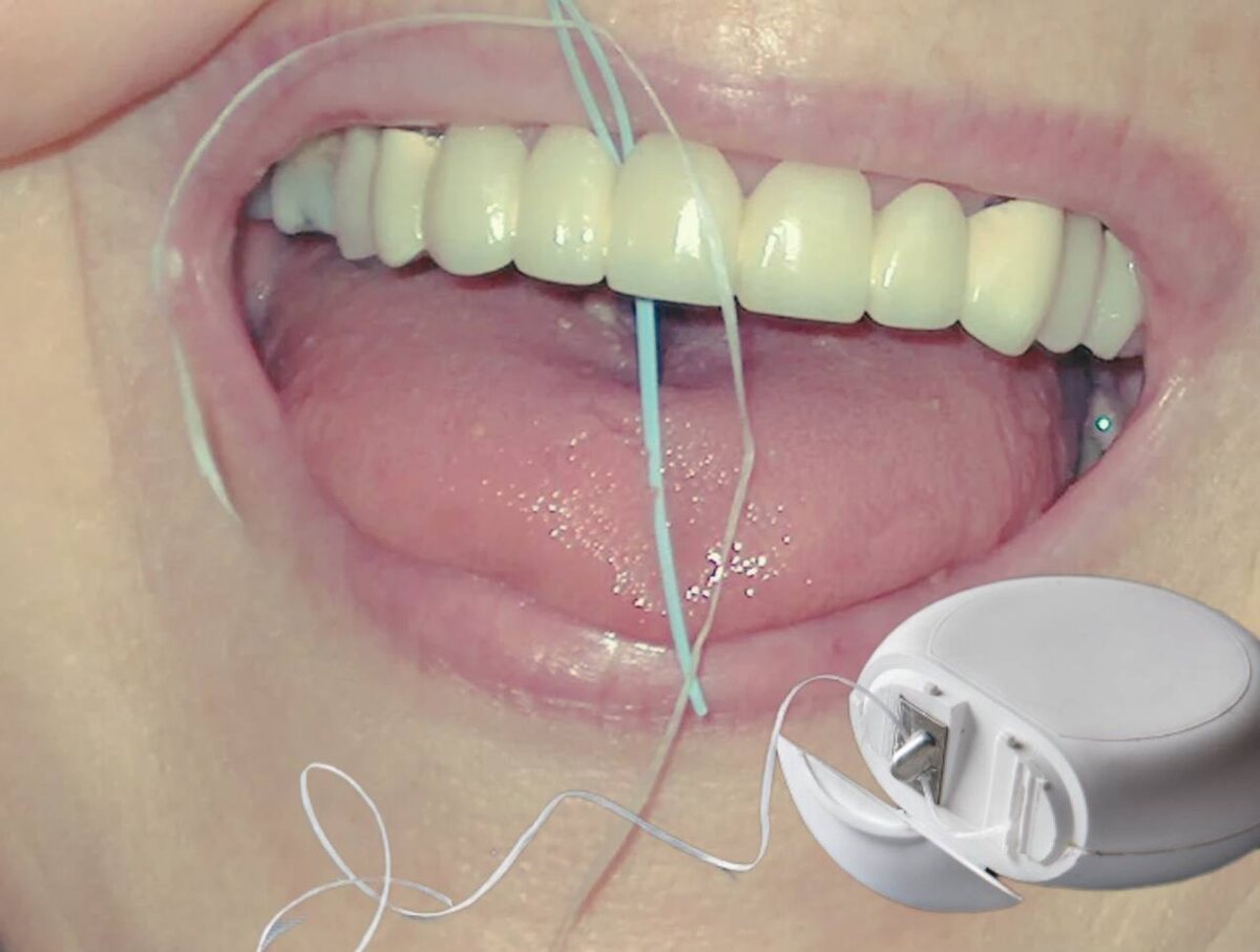 А  вы пользуетесь зубной нитью? 