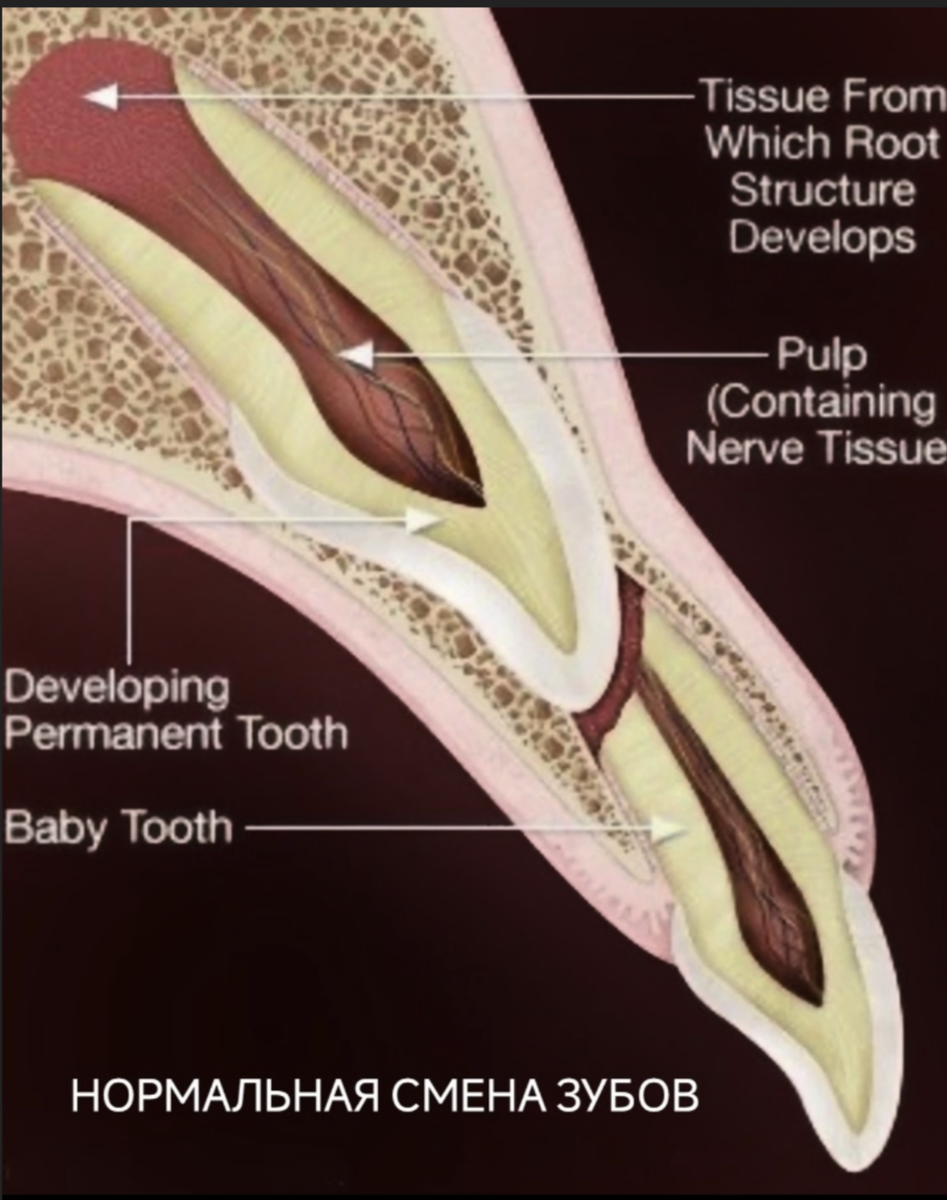 так в норме выглядит нормальная физиологическая смена зубов у собак и кошек.постоянный зуб оказывает давление на молочный , и он выпадает