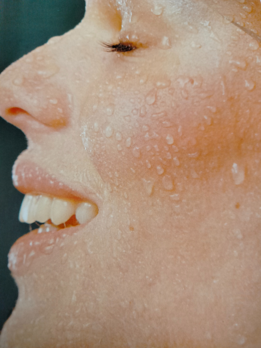 Признаки жирной кожи: