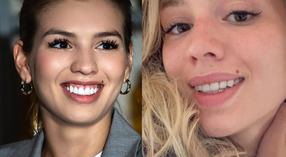 Люся Чеботина рассказала, чем обернулось для нее ношение виниров