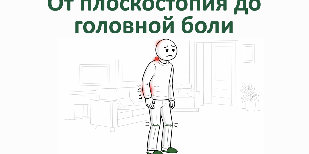 От плоскостопия до головной боли: Невидимая цепь, связывающая стопу и затылок