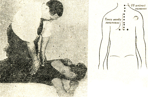 
Рис. 71. Точки для надавливания в межлопаточной области