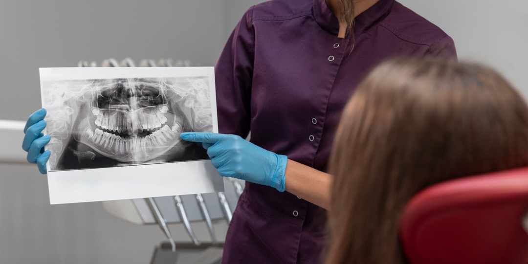 Архитектура здоровой улыбки: зачем нужна гнатология в имплантации зубов?