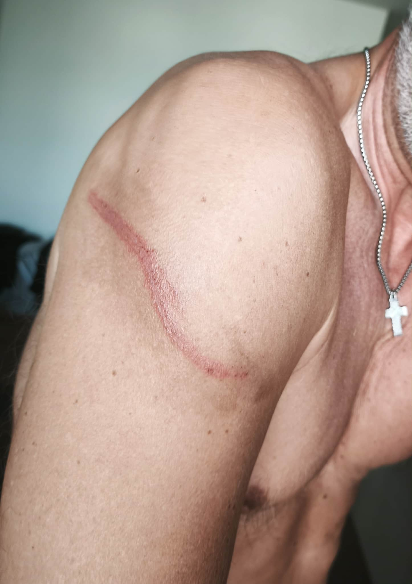 То ли медуза, то ли муравей. 