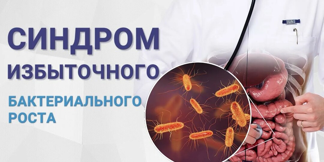 Когда кишечник «перенаселён»: всё, что нужно знать о синдроме избыточного бактериального роста