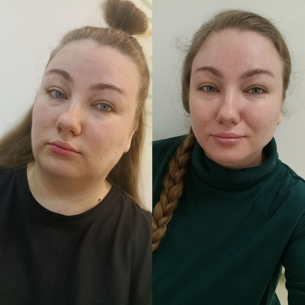 Это я на исследовании в мае и сейчас 😊