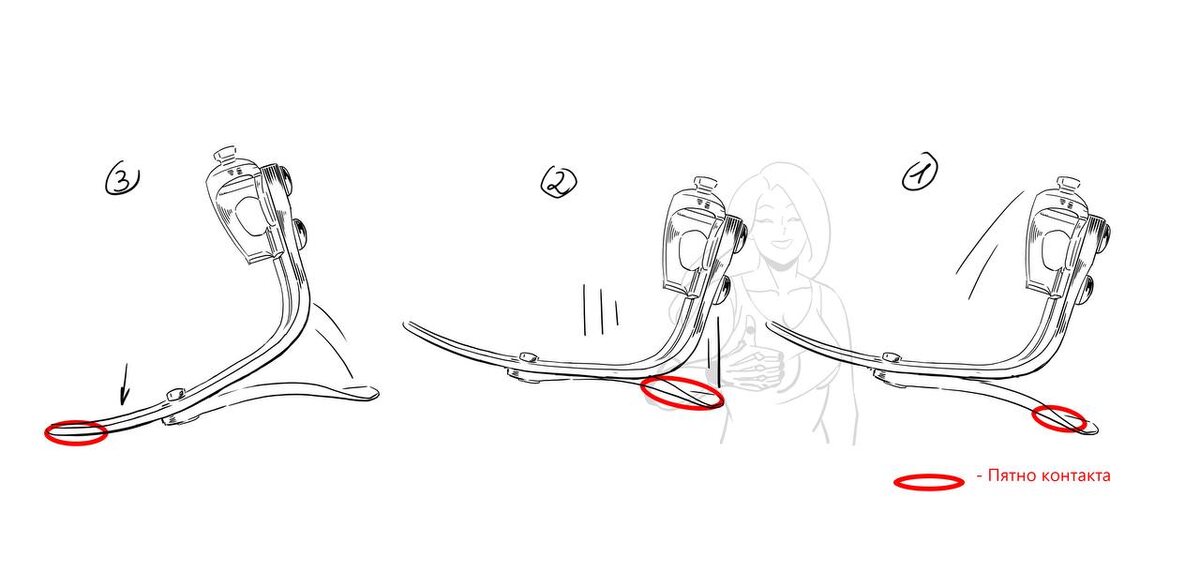 Пример правильной постановки протеза 