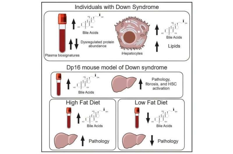    Нарушения работы печени у пациентов с синдромом Дауна и у животных моделей. Роль диеты в компенсации последствий метаболических нарушений.