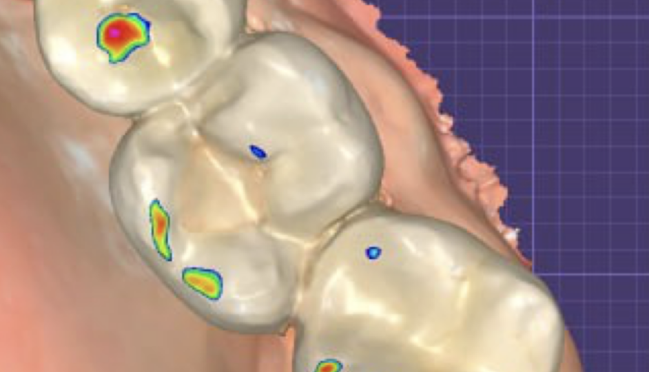 Два случая из моей практики за один день — снова вспоминаем «Банду стоматологов», но уже не смешно