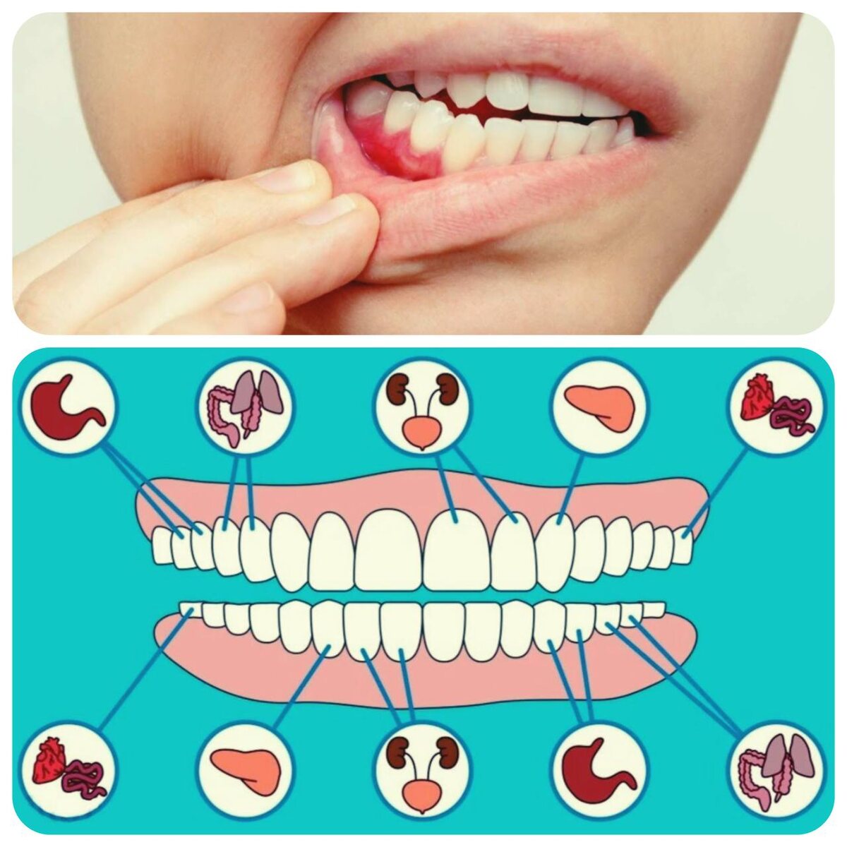 С деснами шутки плохи