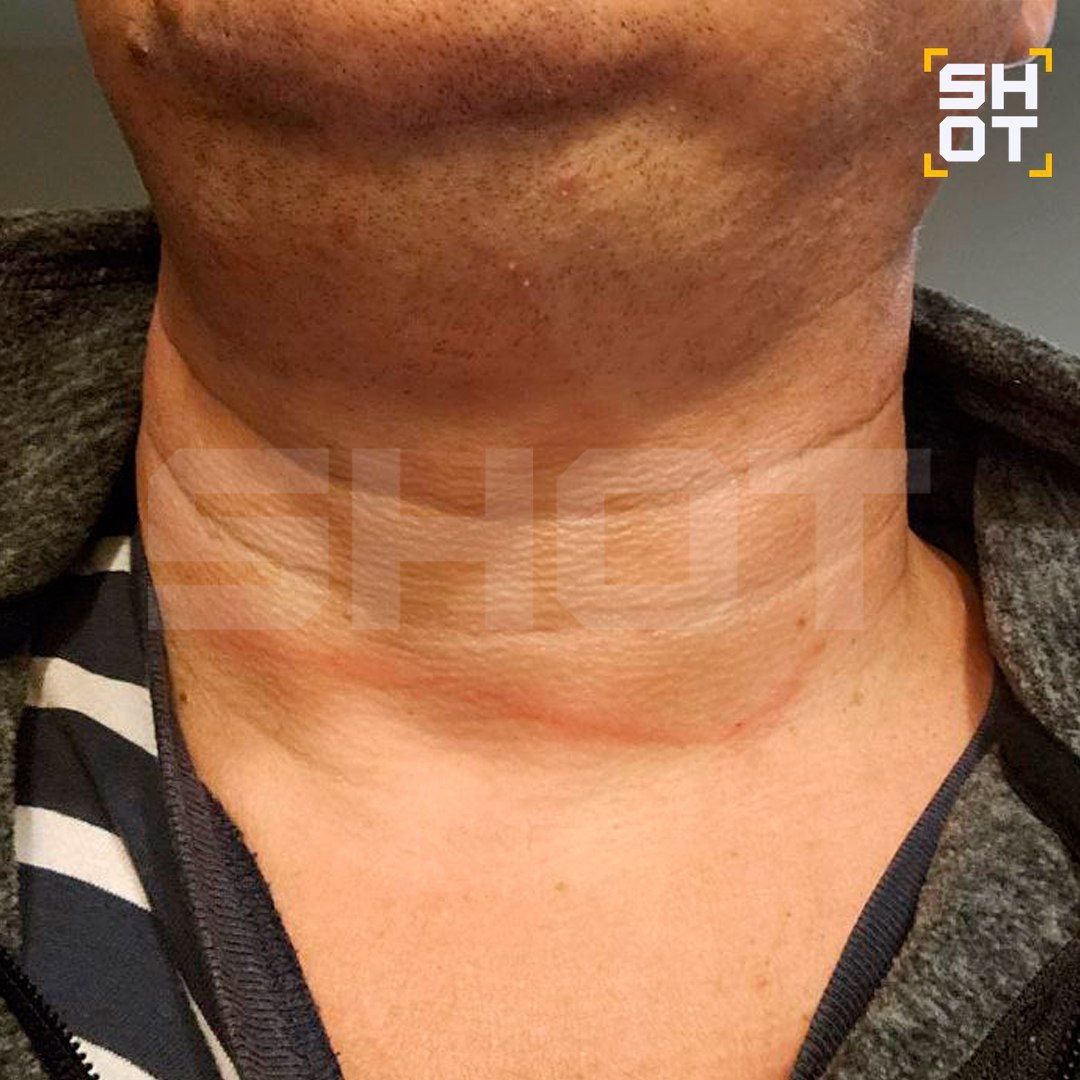 Telegram-канал SHOT 