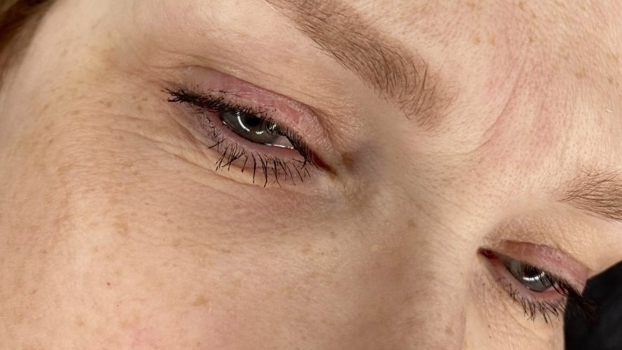 Застой желчи начинается незаметно и отражается на внешности. 5 признаков на лице после 55 лет