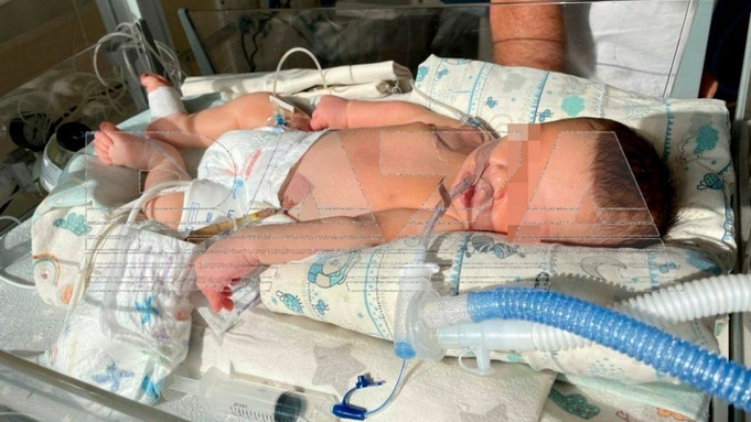 Новорожденный стал инвалидом из-за халатности врачей роддома в Петербурге