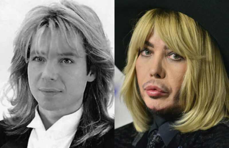    Сергей Зверев: радикальные изменения внешности звезды.