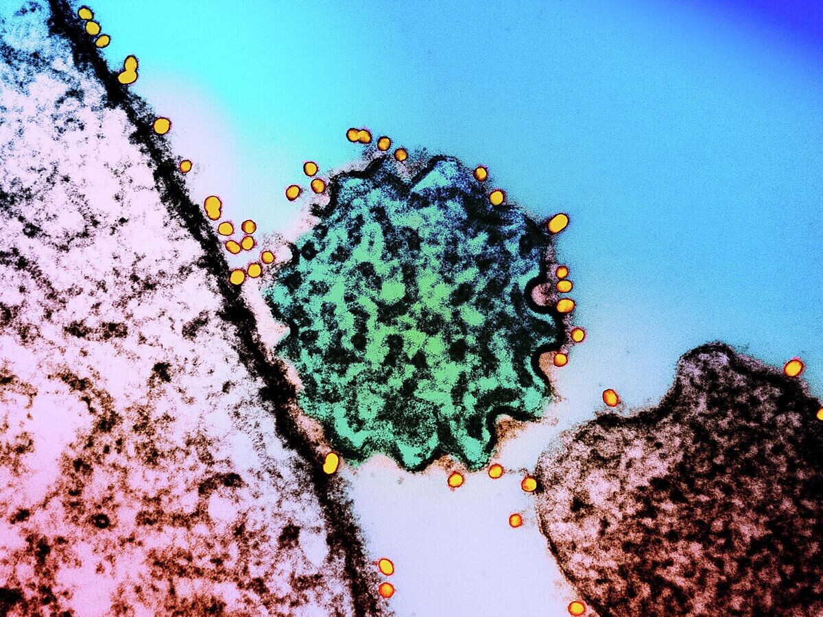    Микрофотография одиночной частицы вируса Нипах | © Getty Images / NIH-NIAID/Image Point FR/BSIP/Universal Images Group
