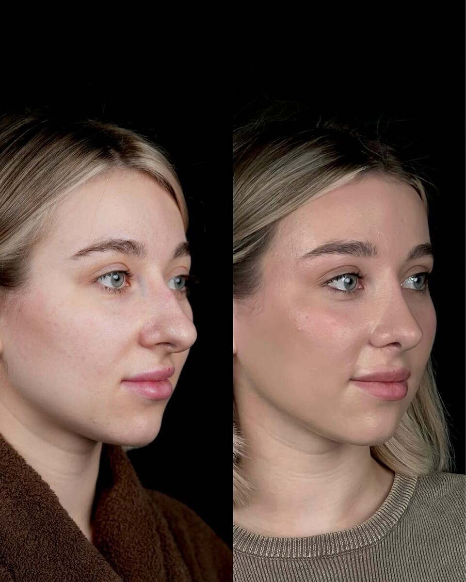 работа пластического хирурга клиники Форма Бурдиной Е.С.