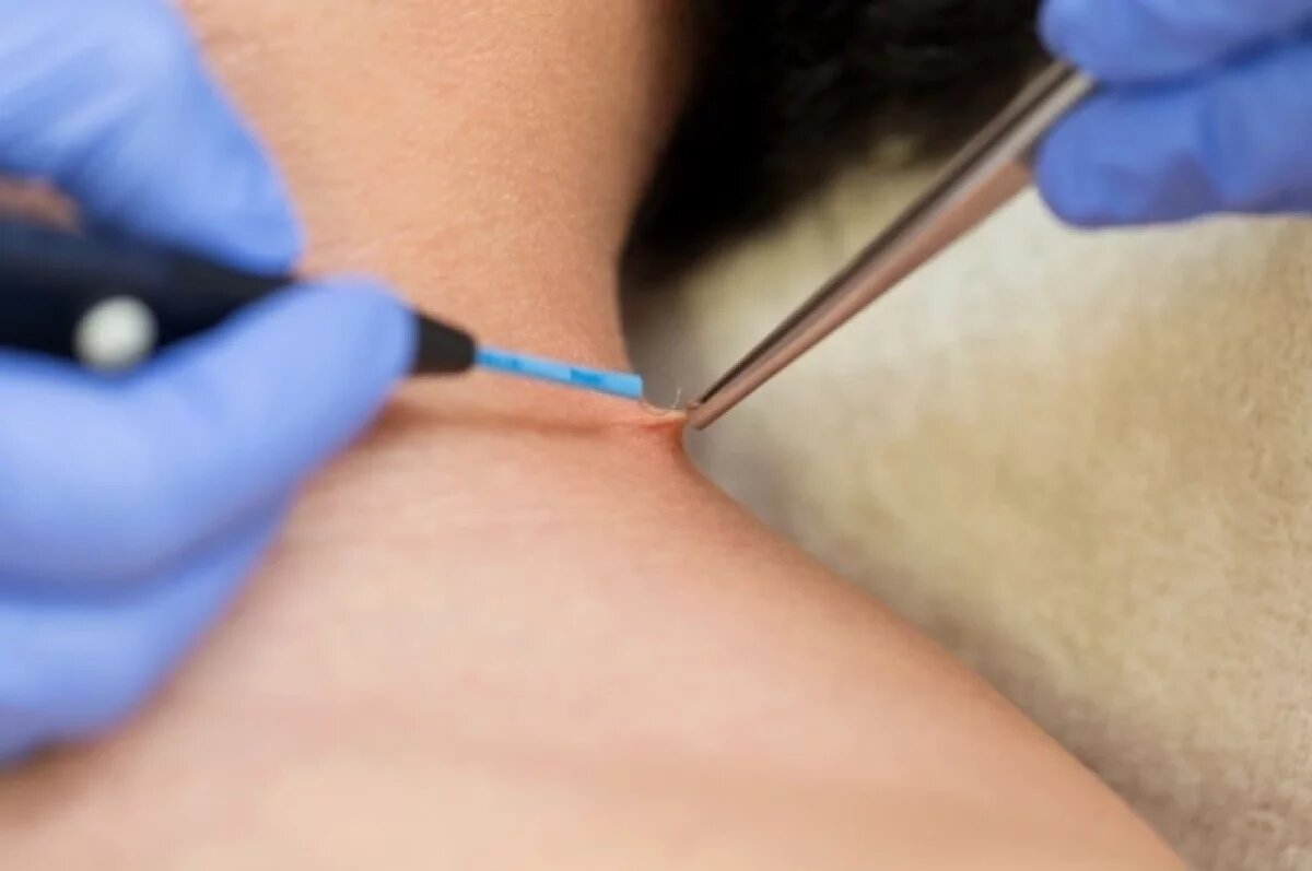    Россиян предупреждают о новом смертельном вирусе Нипах