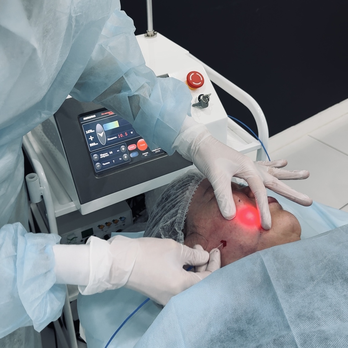 Процедура Эндолифтинг