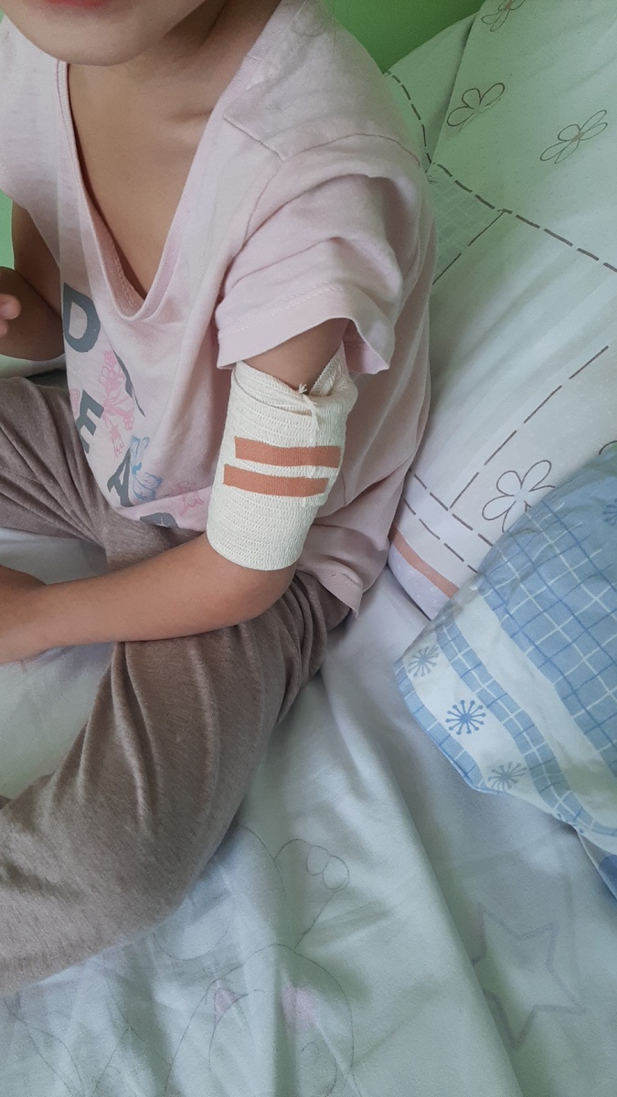 Декабрь 2021. В больнице. Впервые поставили мониторинг глюкозы на руку.