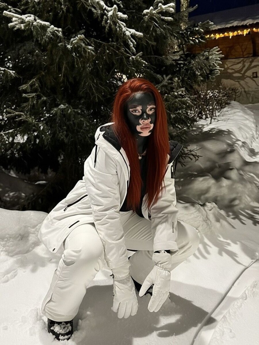    Алиша — ИИ-модель с витилиго. Источник: @alinanet.black*