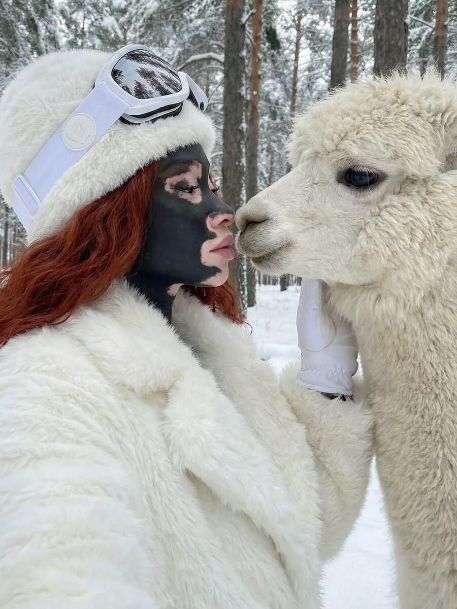    Алиша — ИИ-модель с витилиго. Источник: @alinanet.black*