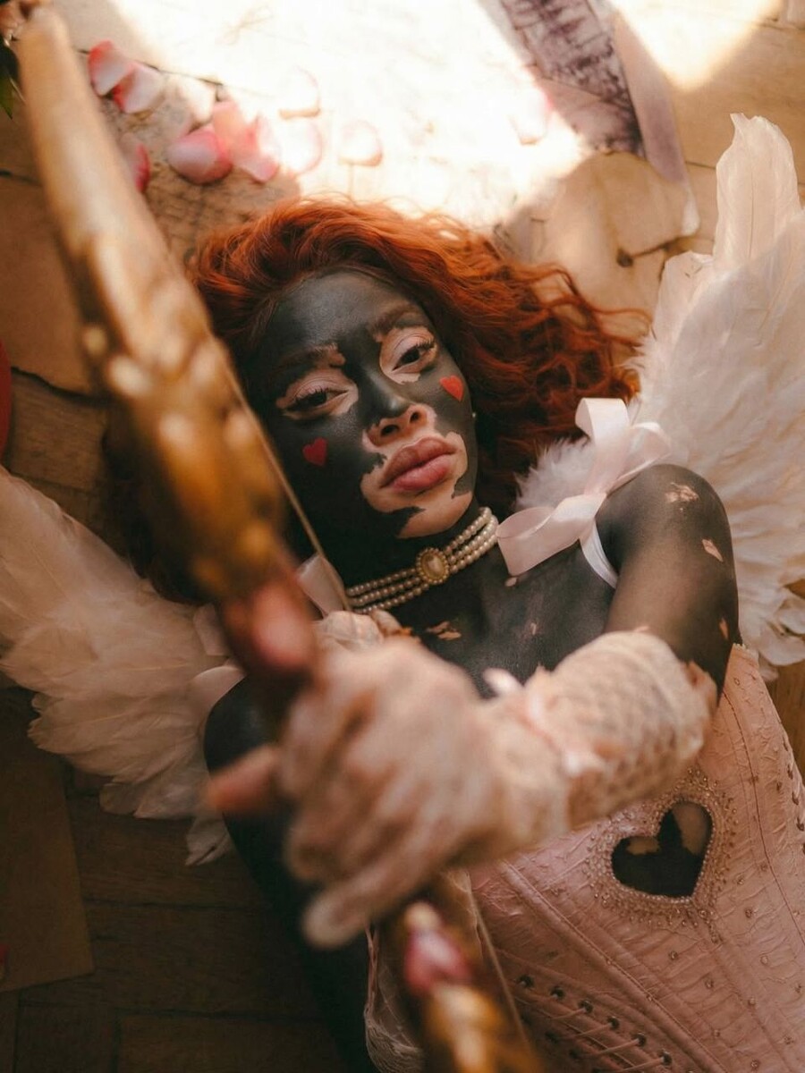    Алиша — ИИ-модель с витилиго. Источник: @alinanet.black*