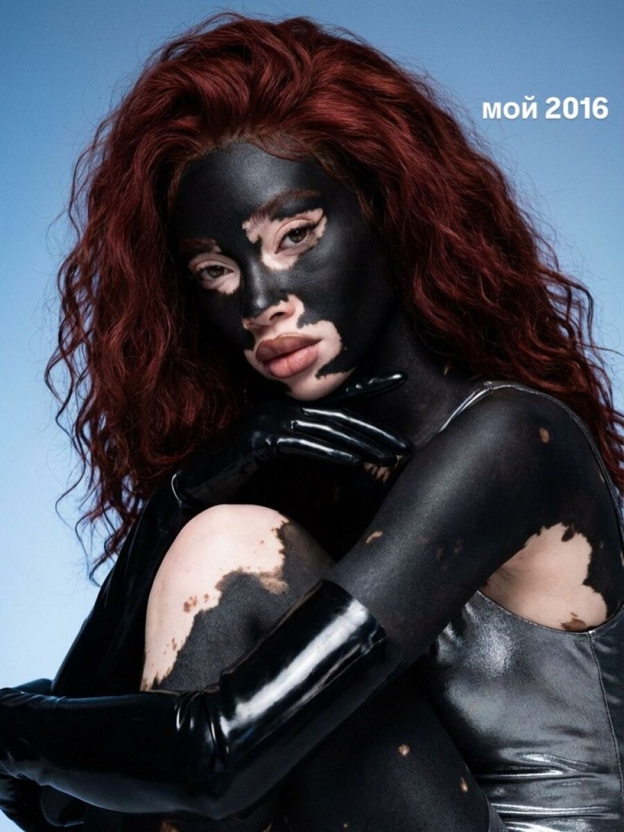    Алиша — ИИ-модель с витилиго. Источник: @alinanet.black*