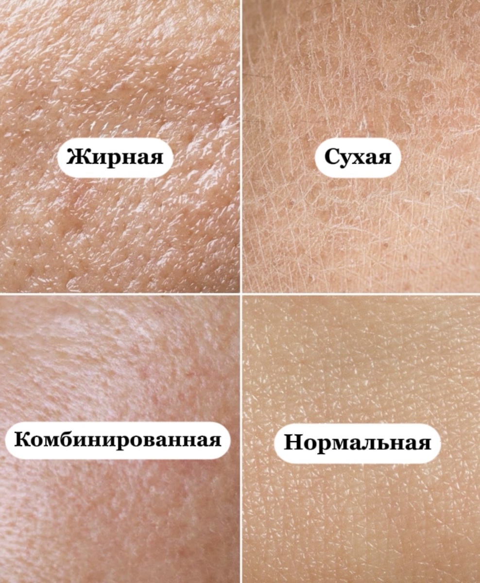 4 типа кожи