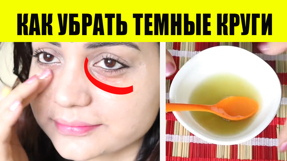 Лечение темных кругов от Яндекса