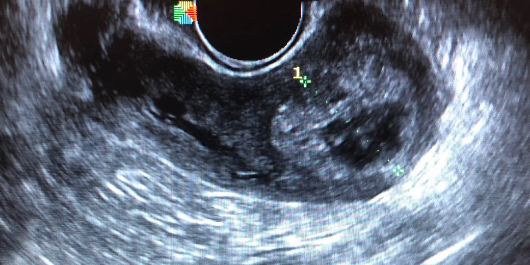 Мужчина - дело наживное
