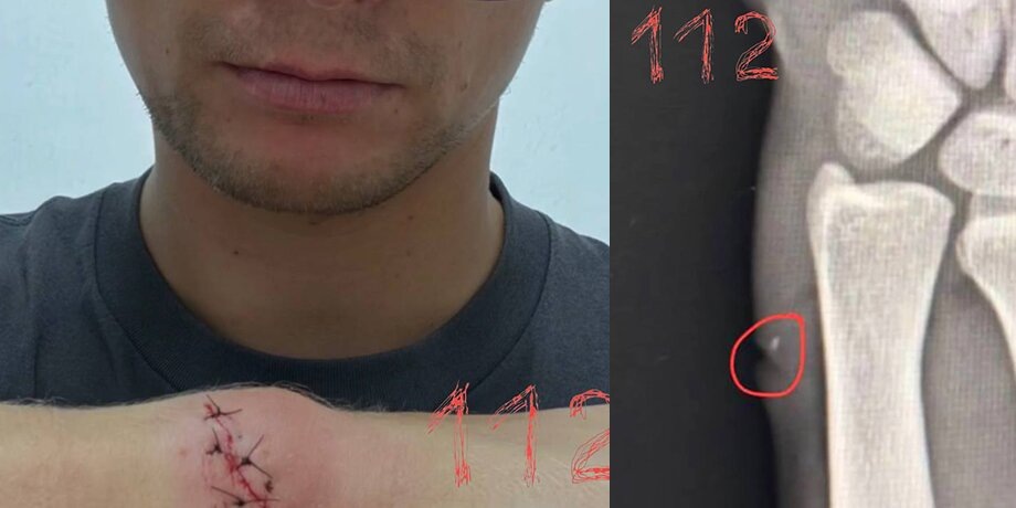    Фото: телеграм-канал "112"