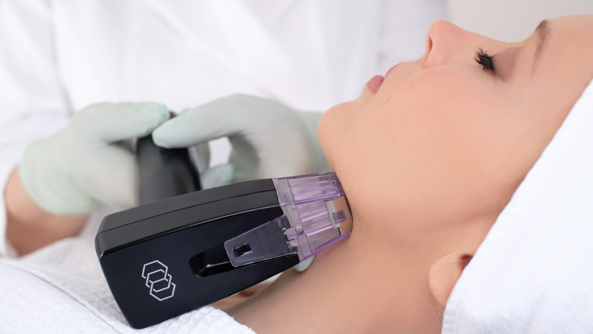 Основной эффект Morpheus 8 проявляется постепенно, потому что коже нужно время на восстановление и ремоделирование тканей, поэтому это не процедура «на завтра»