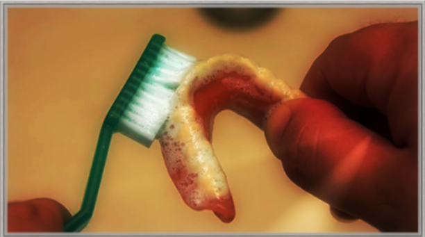 В итоге проблема усугубляется, а человек винит в этом исключительно протез.