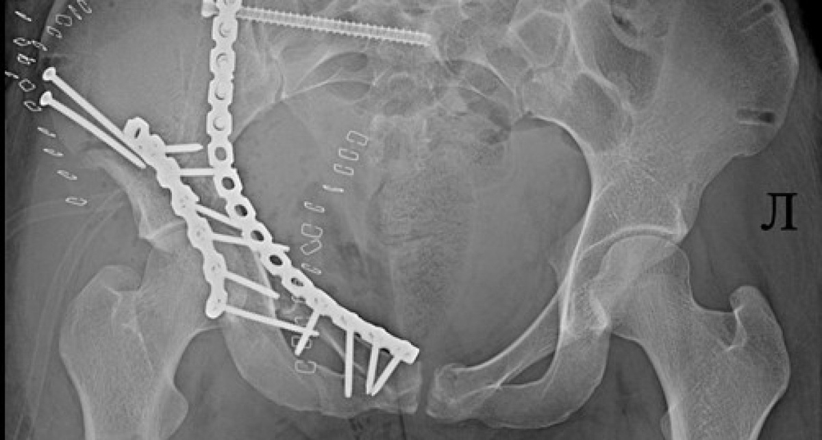    ГАУЗ ЯО Клиническая больница им. Н.В. Соловьёва