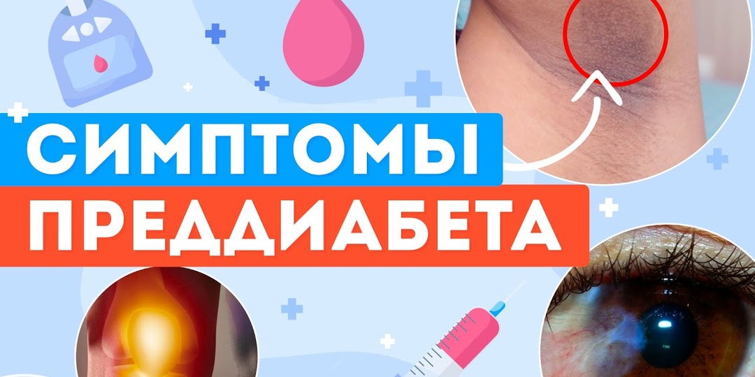 Скрытые признаки сахарных нарушений, которые видно по коже