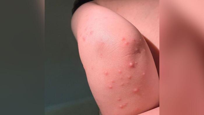 Обложка © Telegram / SHOT