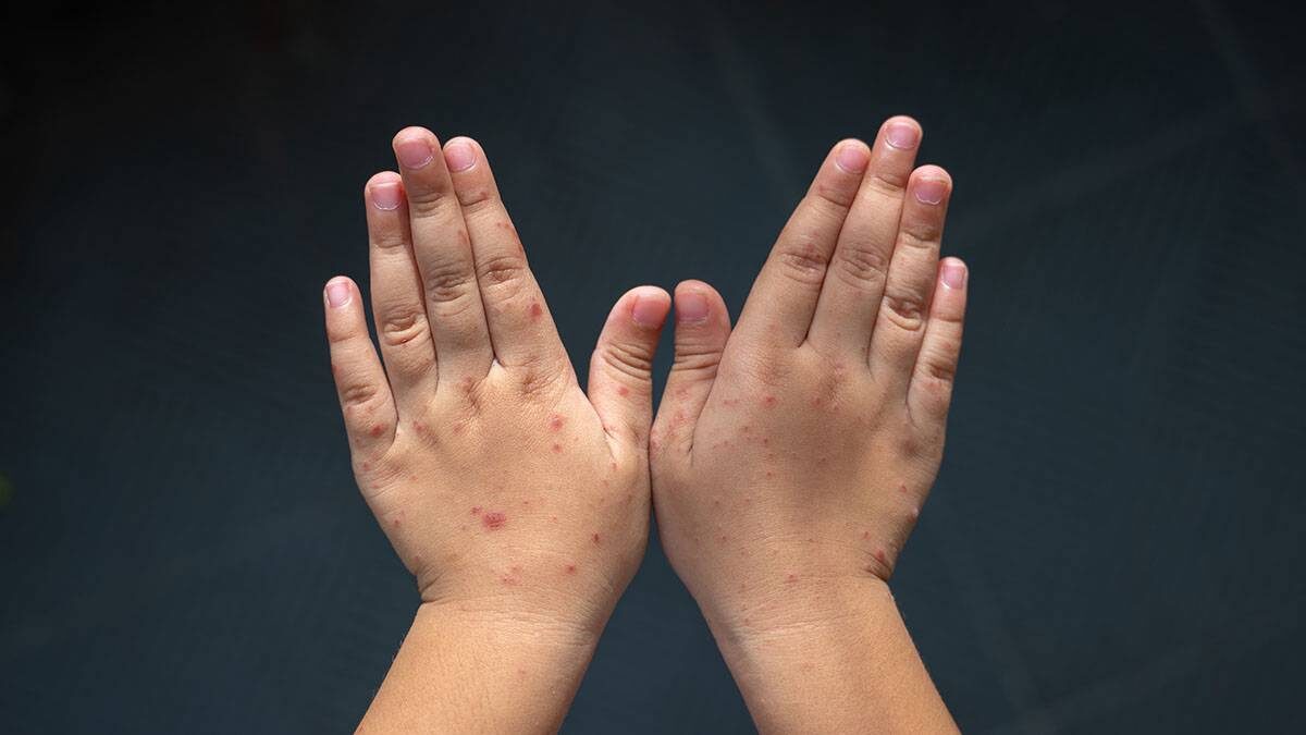    Фото: Shutterstock