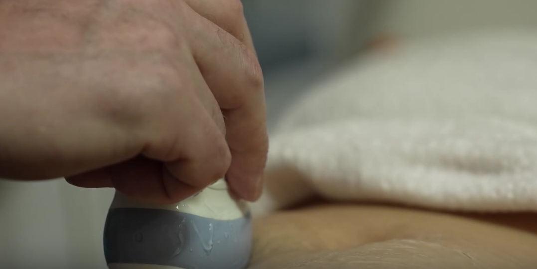 "Беременность есть, а ребенка в матке нет": уникальная малышка родилась из брюшины матери в Магнитогорске