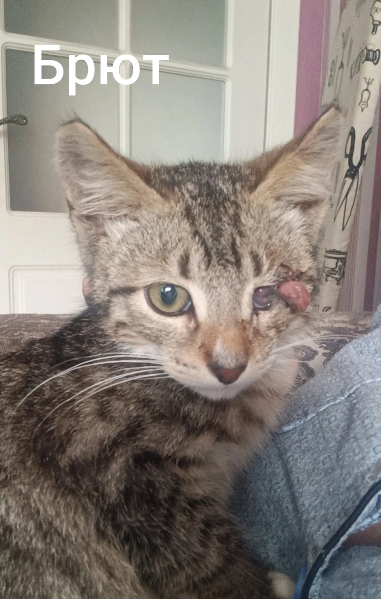 Брюта нашли с травмированным глазом