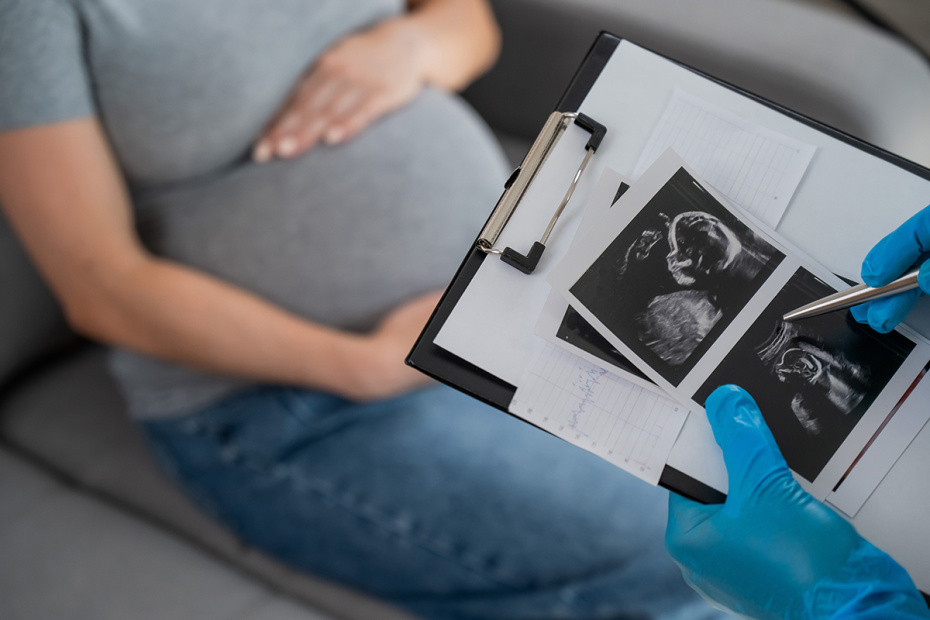    Shutterstock/FOTODOM