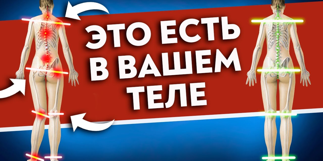 Как исправить ПЕРЕКОС ТЕЛА? Большая асимметрия НЕ норма!