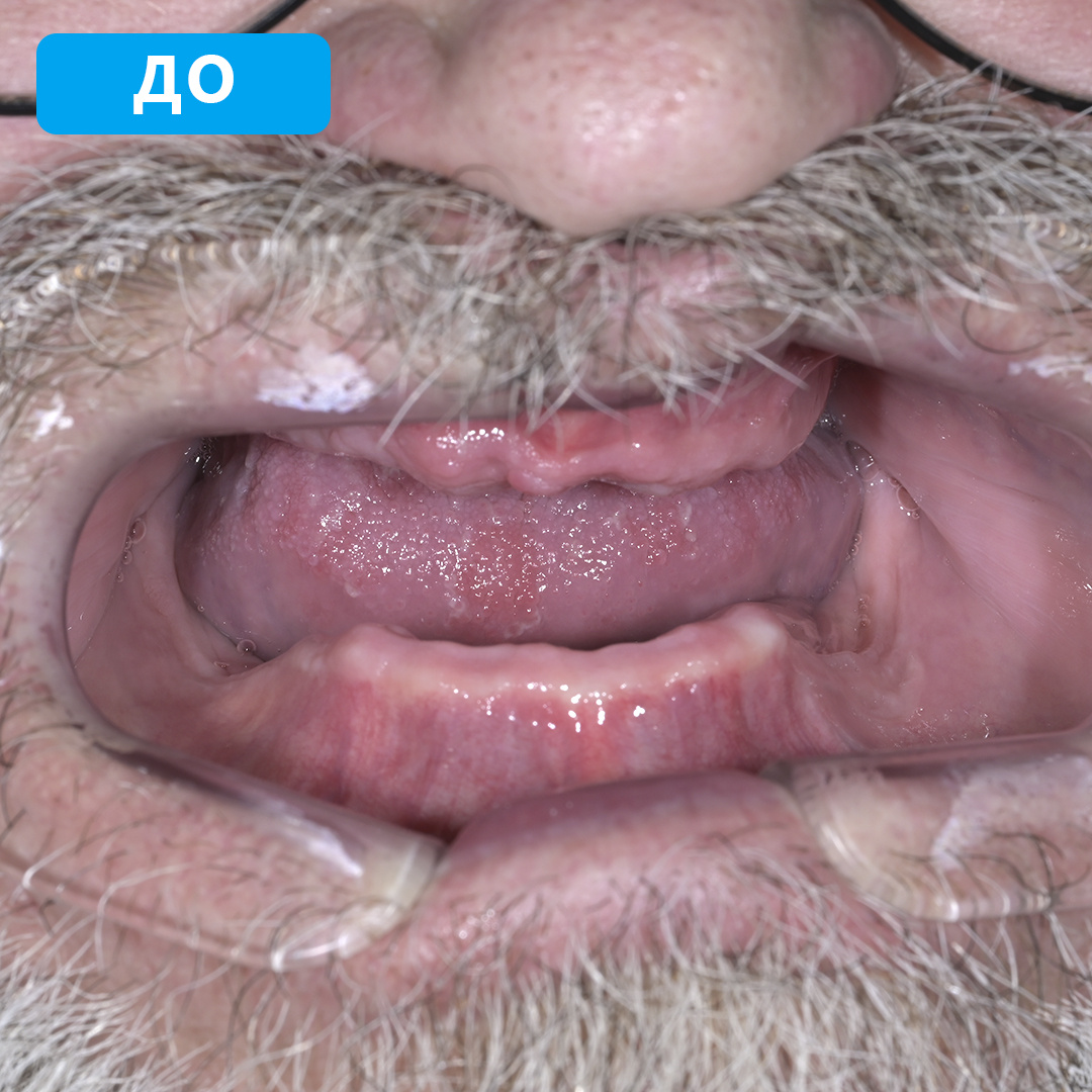 Первое обращение в стоматологию Денталюкс Рязань
