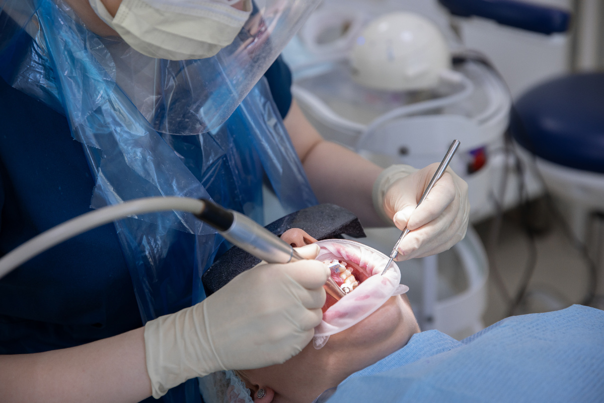 Профессиональная гигиена — обязательный этап перед имплантацией.