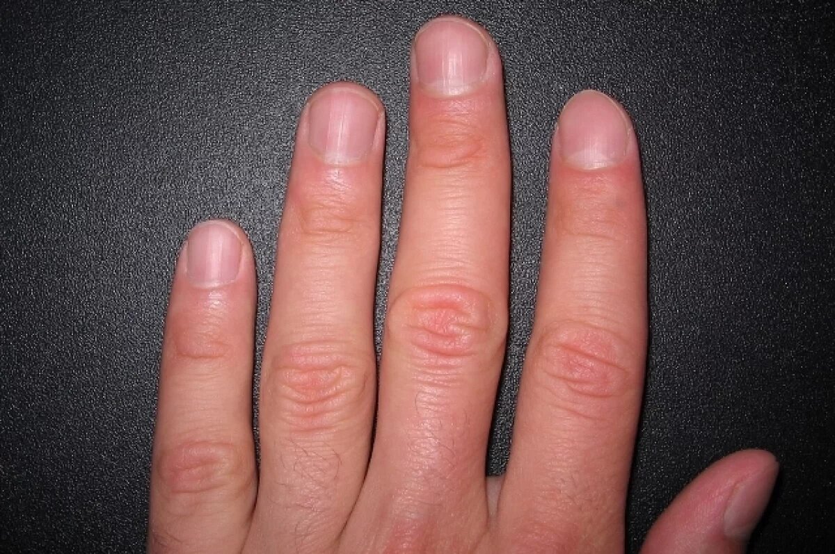    Mirror: по цвету ногтей можно узнать о проблемах с печенью и диабете