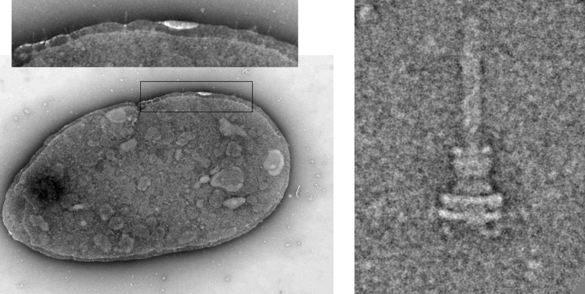    Микрофотографии сальмонеллы Salmonella enterica (слева) и её «инъектора», комплекса секреции T3SS (справа) / © Julia Mayr and Thomas Marlovits