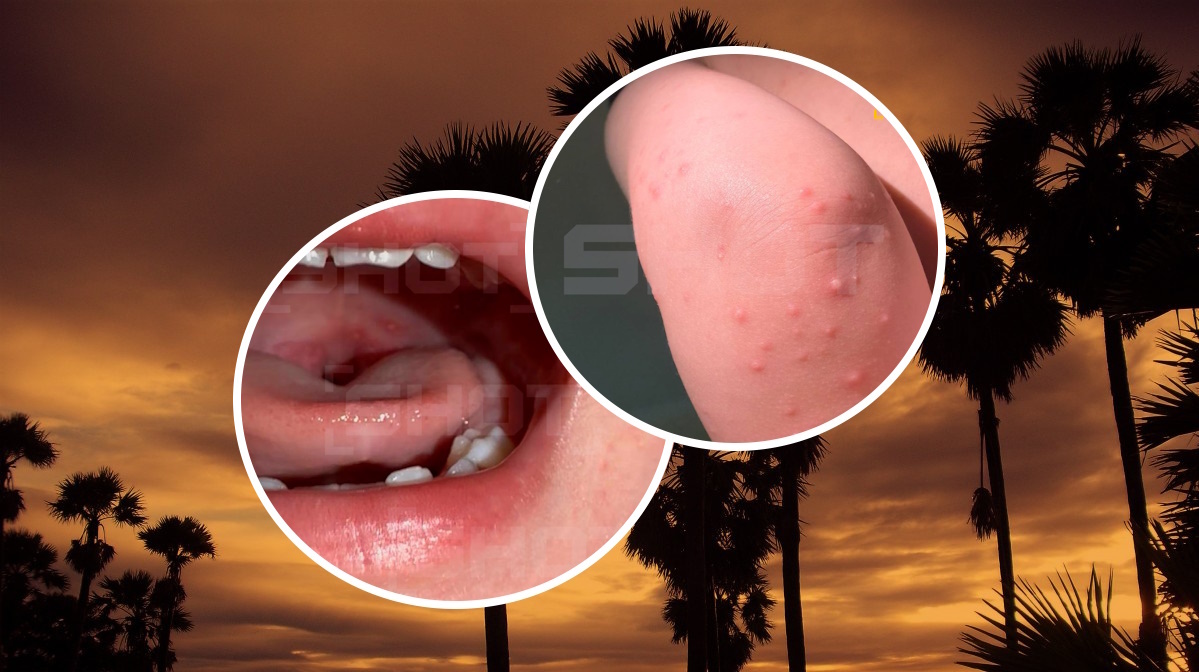 Фото: SHOT; pxhere